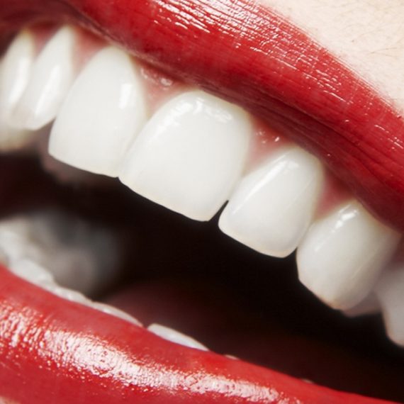Buy Dental Check-Up With Optional Stain Removal, Or Laser Teeth Whitening Mega Deals Now at Special Price in SaudiMegaDeals.com Dental Check-Up With Optional Stain Removal, Or Laser Teeth Whitening DENTISTRY Shop Online at Special Price from Saudi Mega Deals
